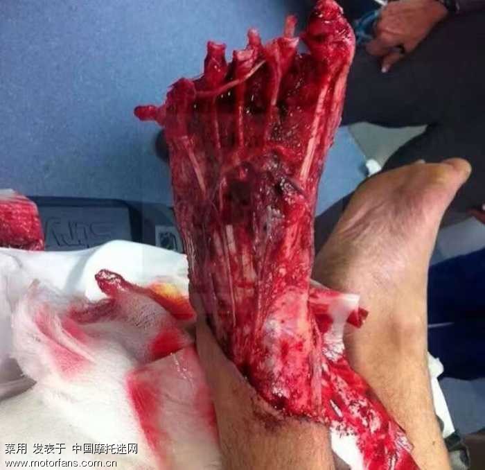 加装abs系统(7.4 一楼更新使用情况) - 第4页 - 北京摩友交流区 - 摩托车论坛 - 中国摩托迷网 将摩旅进行到底!